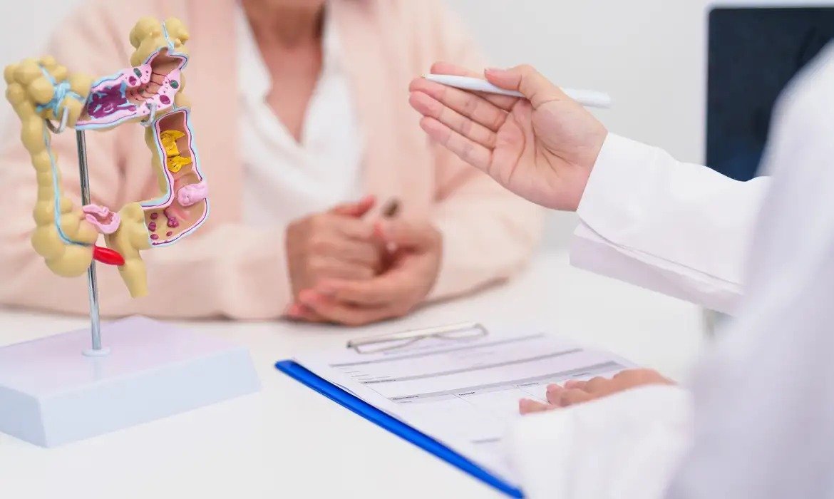 Teste FIT no SUS reforça prevenção do câncer colorretal